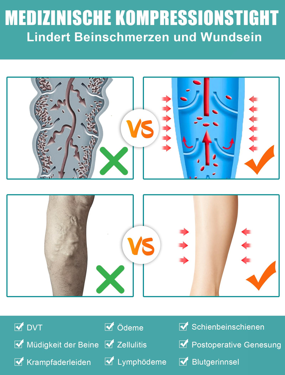 Evolyline Medical Compression Stockings 15-20 mmHg – Thigh High